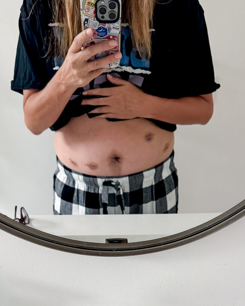 Pacific Yoga & Fitness, online yoga instructor, shares Yoga After A Hysterectomy. Yoga Retreat